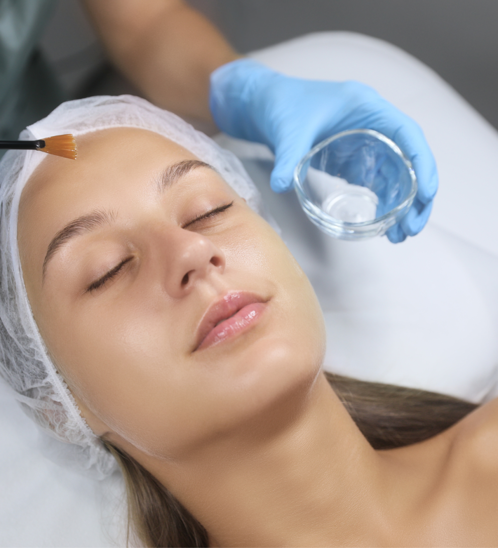 chemical peel (2)