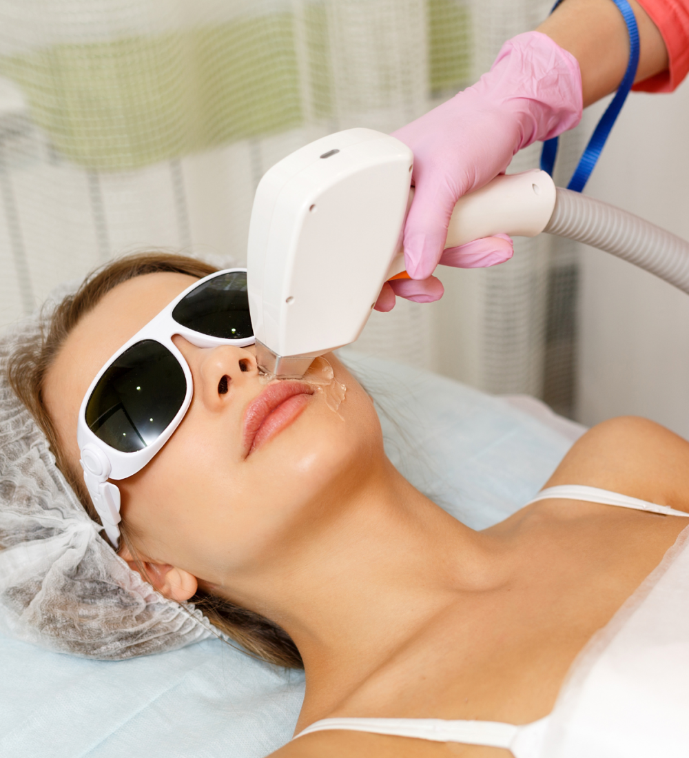 laser hair removal (3)